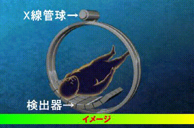 CTのイメージ図